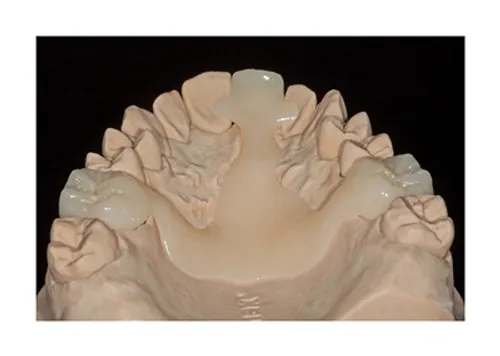 Zahntechnische Arbeit aus dem PC-Dental Labor